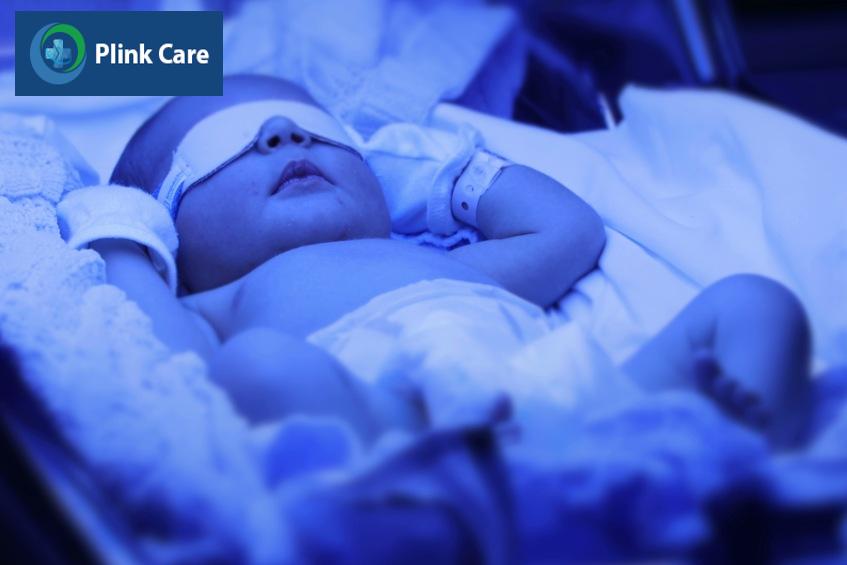 Chiếu đèn là lựa chọn đầu tiên khi điều trị vàng da sơ sinh