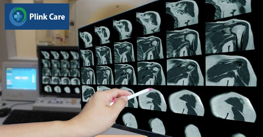 Chuẩn đoán bằng hình ảnh là phương pháp phổ biến để xác định u mỡ