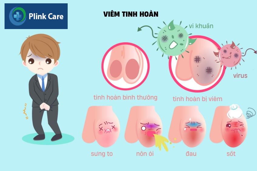 dấu hiệu viêm tinh hoàn ở trẻ em