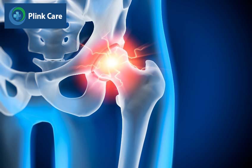 Đối tượng bị đau khớp háng đang dần trẻ hóa
