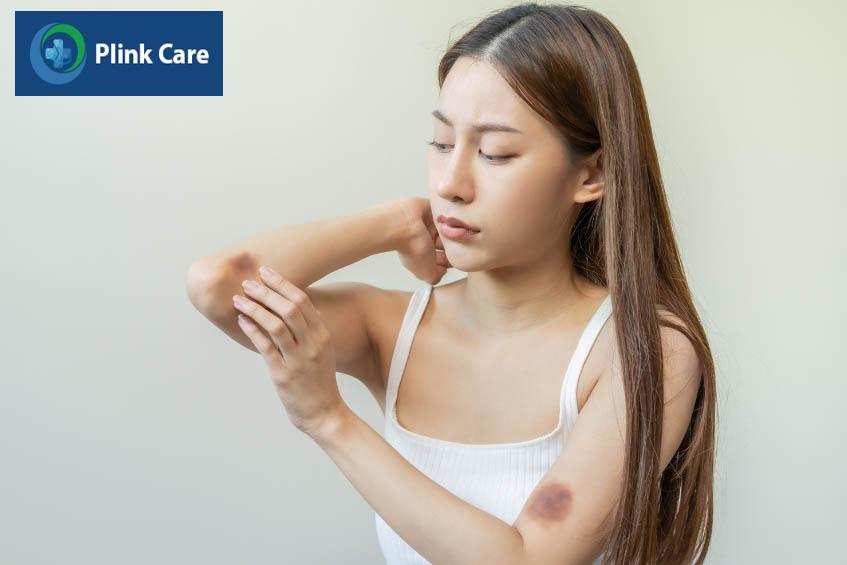 Dùng thuốc Brilinta có thể gây dị ứng