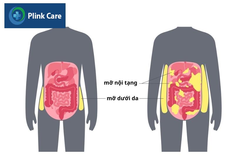 giảm mỡ nội tạng