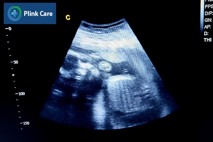 Hình dáng và kích thước của thai 19 tuần tuổi khi siêu âm