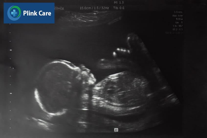 Hình dạng và kích thước của thai 20 tuần tuổi khi siêu âm
