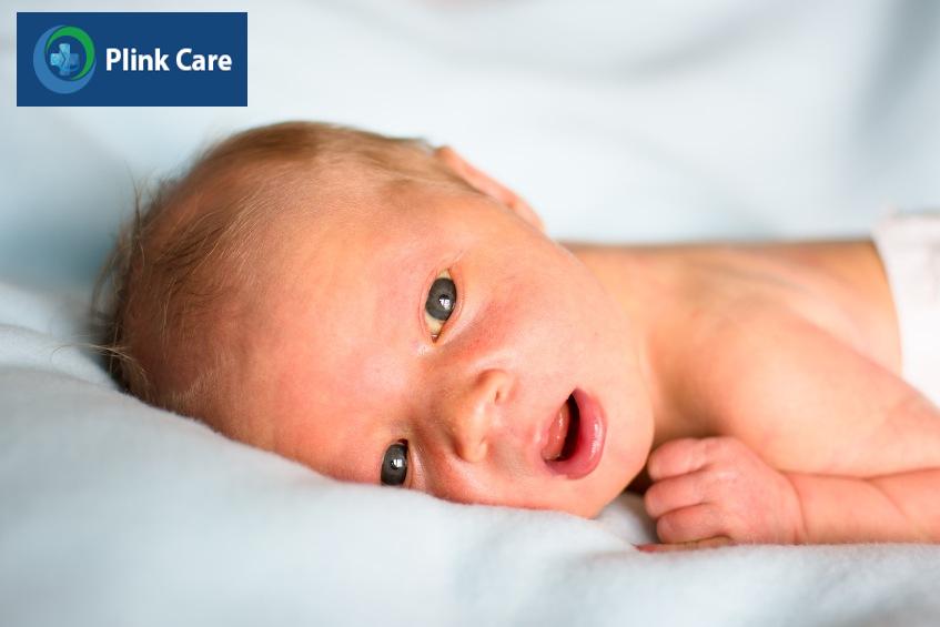 Kết mạc mắt chuyển vàng do nồng độ bilirubin tăng cao