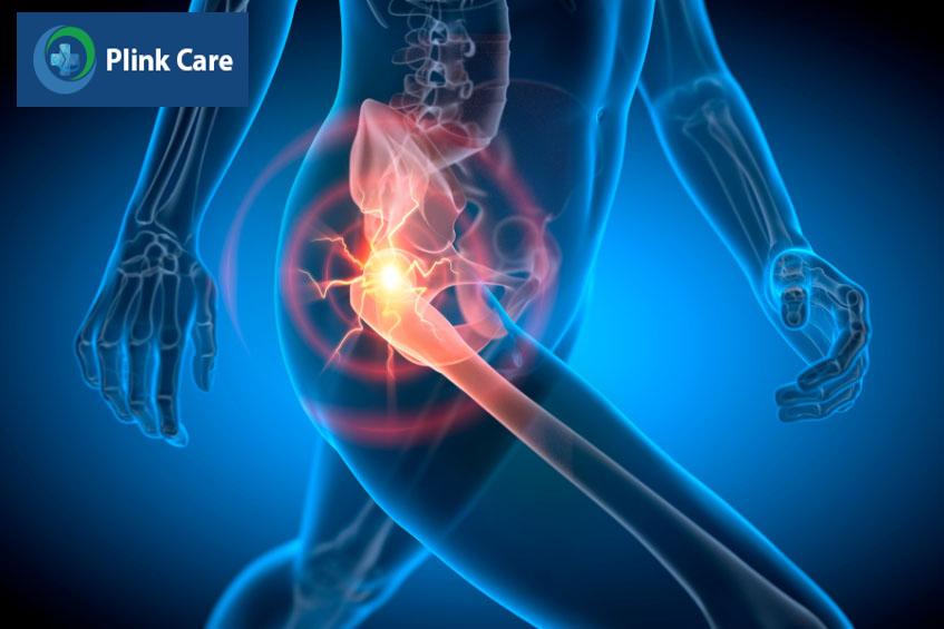 khớp háng kêu lộp cộp có nguy hiểm không?