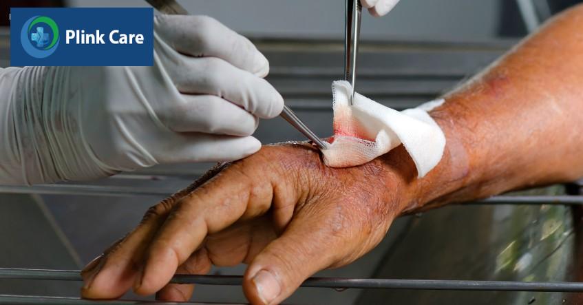 lưu ý khi điều trị mụn thịt