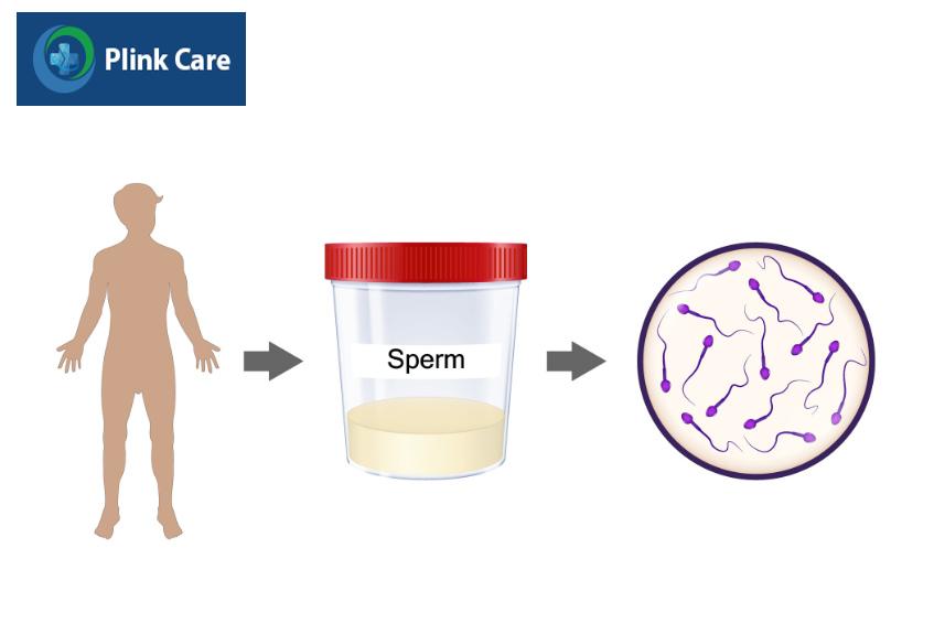 mật độ tinh trùng giúp đánh giá khả năng sinh sản của nam giới