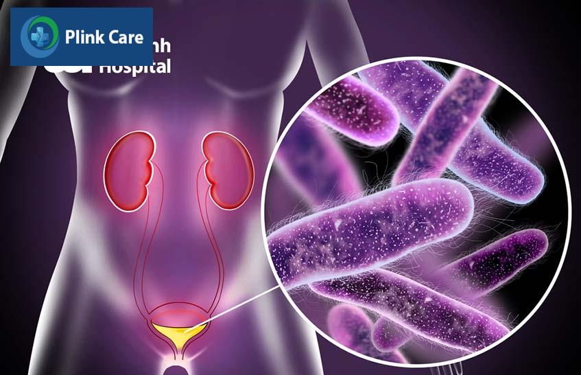 Nguyên nhân nhiễm trùng đường tiết niệu ở nữ