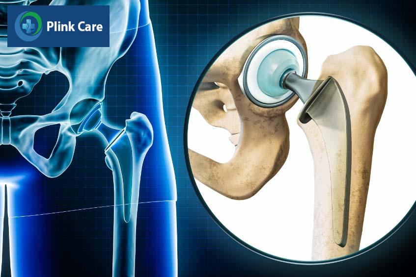 Khi bị khô khớp nặng, người bệnh có thể cần phẫu thuật để điều trị