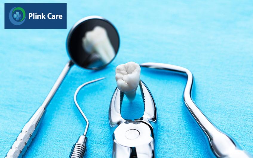 răng khôn mọc lệch cần được nhổ bỏ