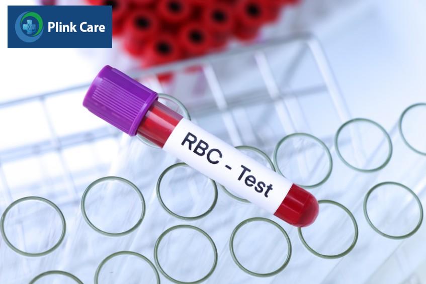 rbc là chỉ số chẩn đoán thiếu máu