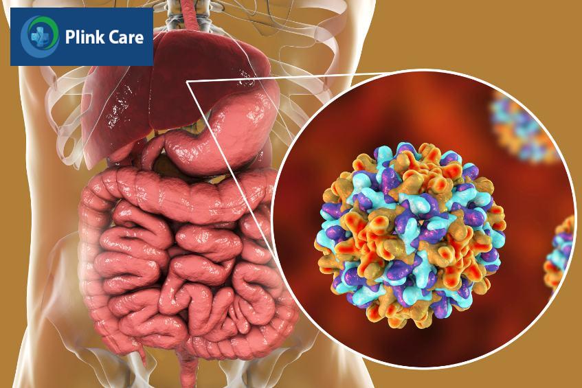 suy tủy do virus viêm gan