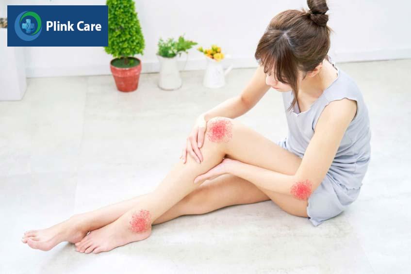 Tại sao khớp lại kiêu lụp cụp