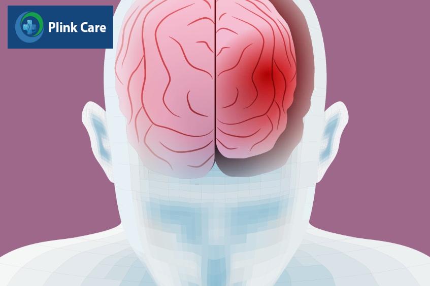teo não gây mất tế bào não giảm kết nối giữa các nơron