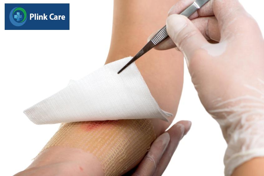 Thay băng vết bỏng cho trẻ cần đảm bảo vệ sinh