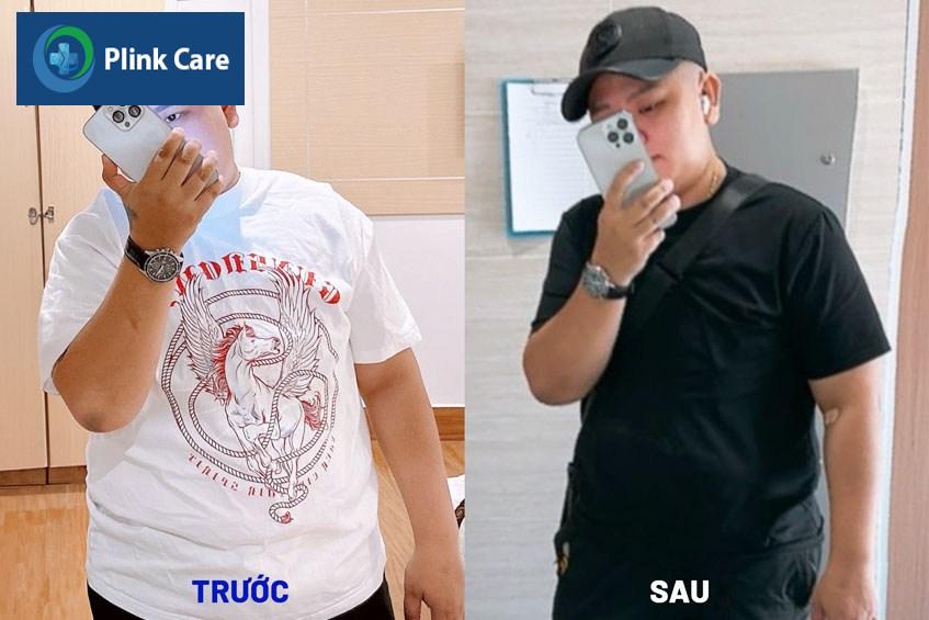 trước và sau khi giảm cân nam