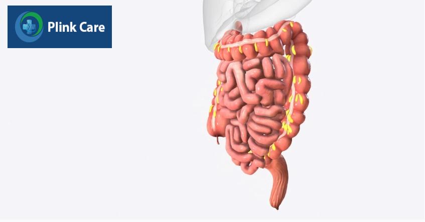viêm xơ hóa mạc treo
