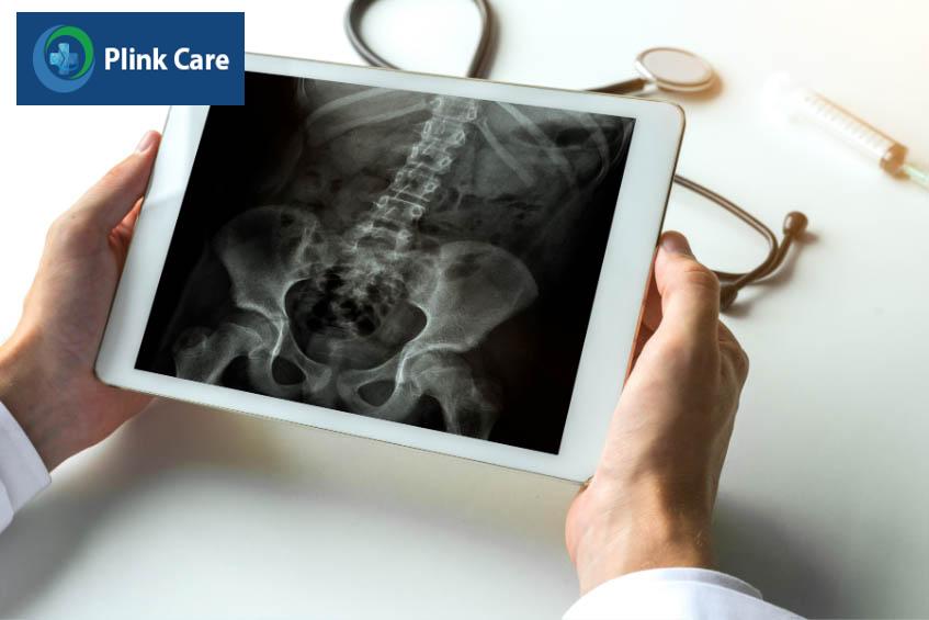 Xét nghiệm hình ảnh chẩn đón đau khớp háng