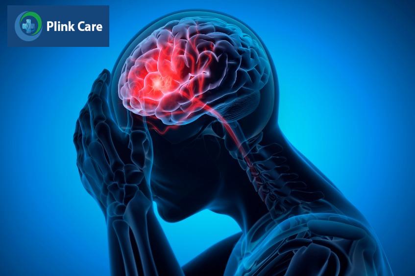 xuất huyết não nguy hiểm cần chăm sóc sau điều trị