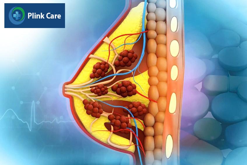biểu hiện của khối u ác tính sớm
