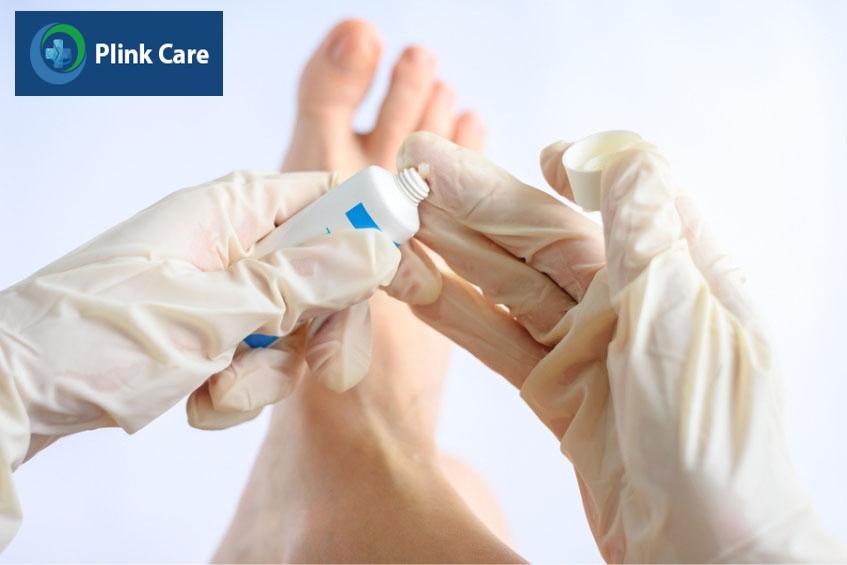 Bôi thuốc điều trị nấm móng ngón chân