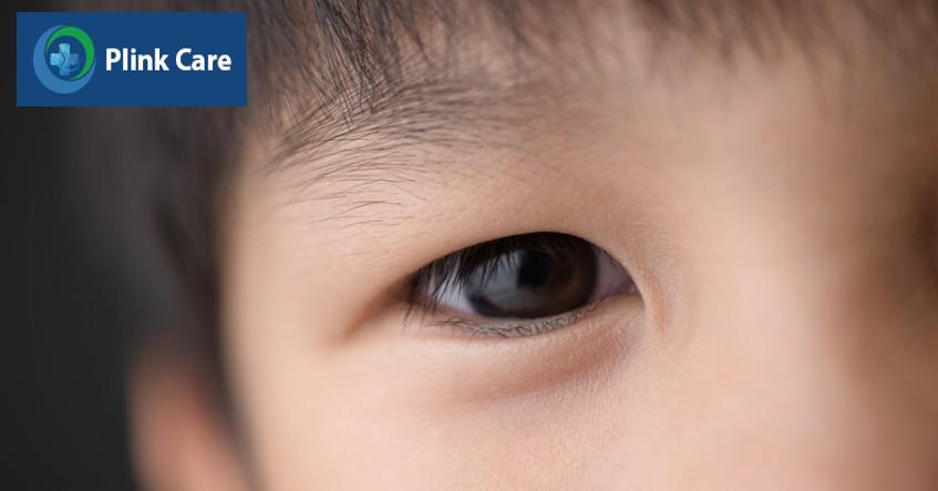 cẩn thận nếu có bất thường ở mắt trẻ