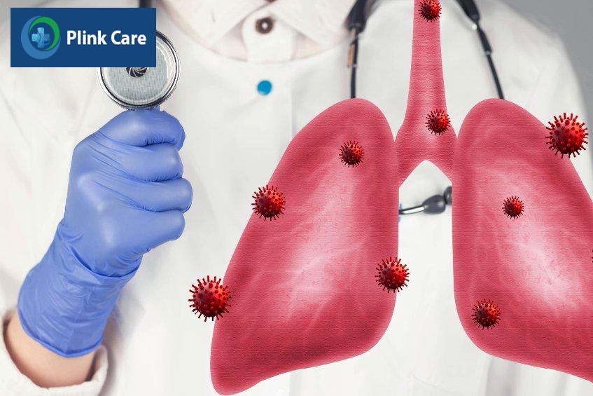 chẩn đoán và điều trị viêm phổi cộng đồng càng sớm càng tốt