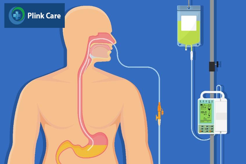 chữa rò khí quản thực quản