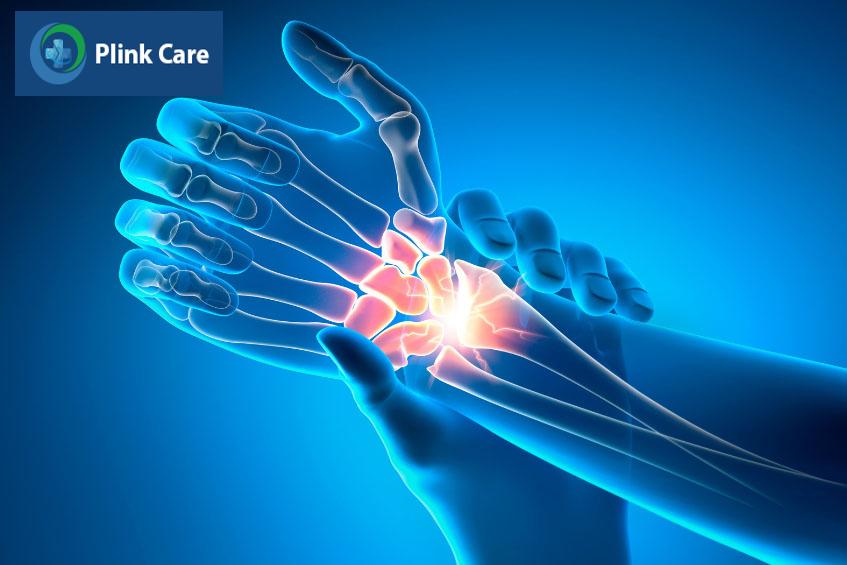 Đau cứng khớp cổ tay là gì?