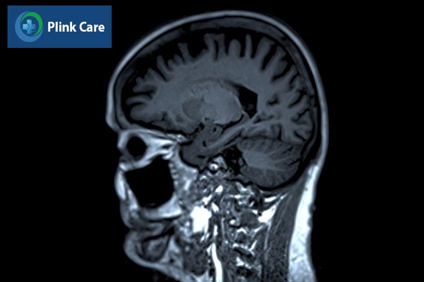 hình ảnh mri đầu mặt cổ