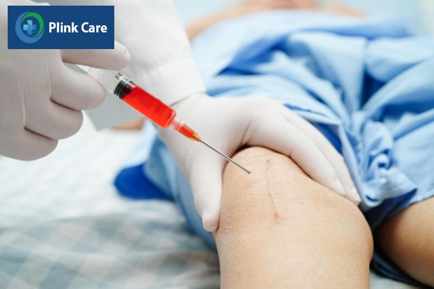 Hút lấy dịch khớp chẩn đoán lý do sưng đầu gối