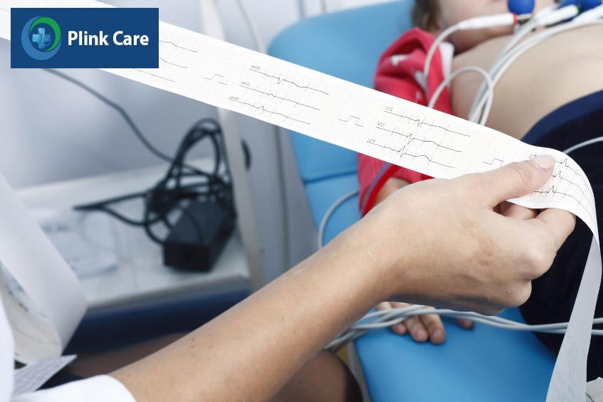 Kết quả từ phương pháp điện tâm đồ ECG có thể giúp bác sĩ chẩn đoán hội chứng Wolff-Parkinson-White