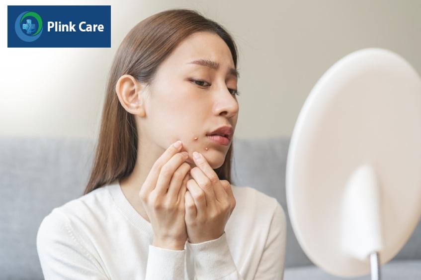 không chạm hoặc nặn mụn nhọt