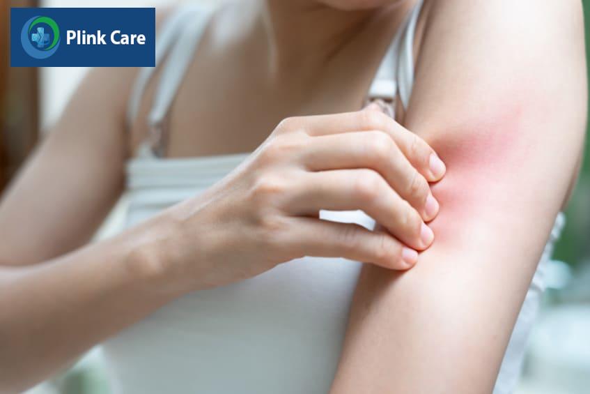 Không sử dụng thuốc cho người mẫn cảm với đậu nành, đậu phộng