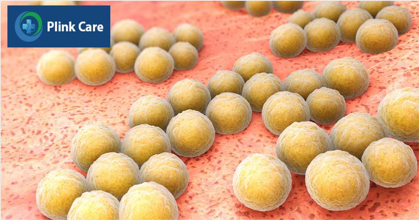 khuẩn tụ cầu staphylococcus aureus gây mụn nhọt