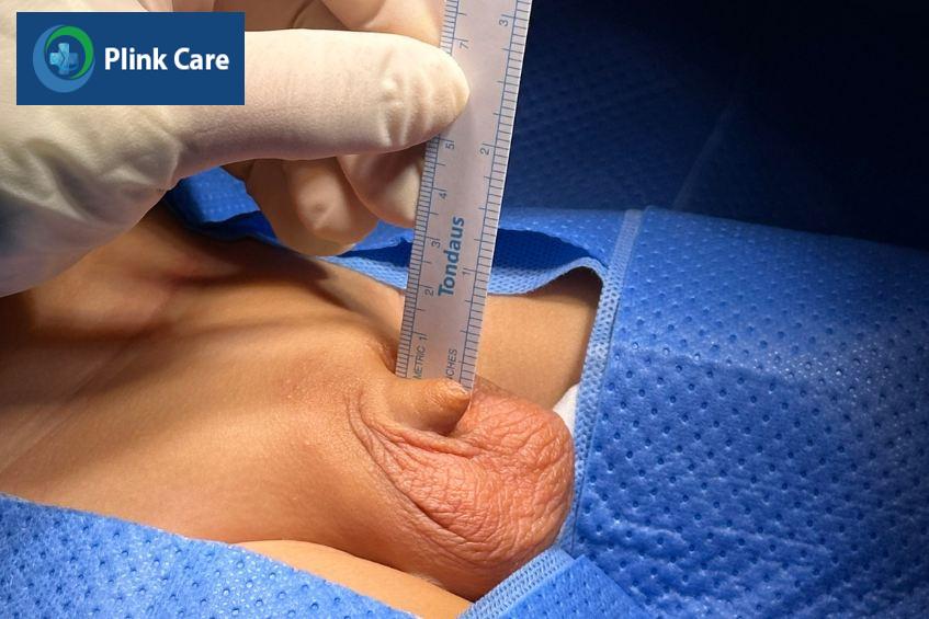 Kiểm tra, định hình kích thước, chiều dài dương vật