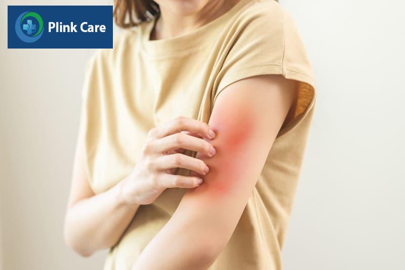 Một số trường hợp có thể bị ngứa da sau khi dùng thuốc Tebonin 120mg