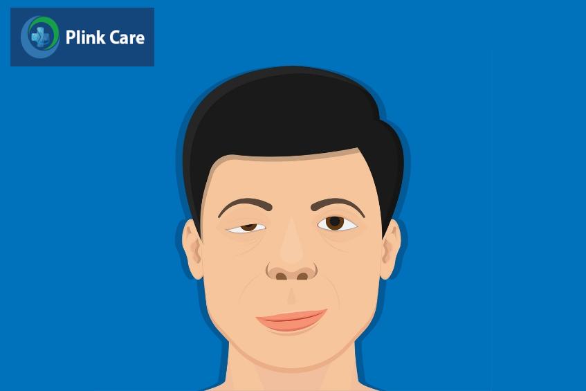 người bệnh nhược cơ sống được bao lâu