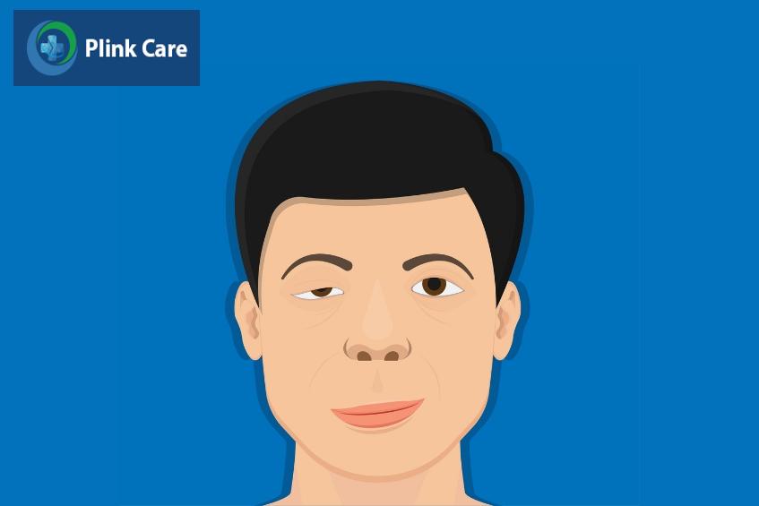 nhược cơ không phải bệnh lý di truyền