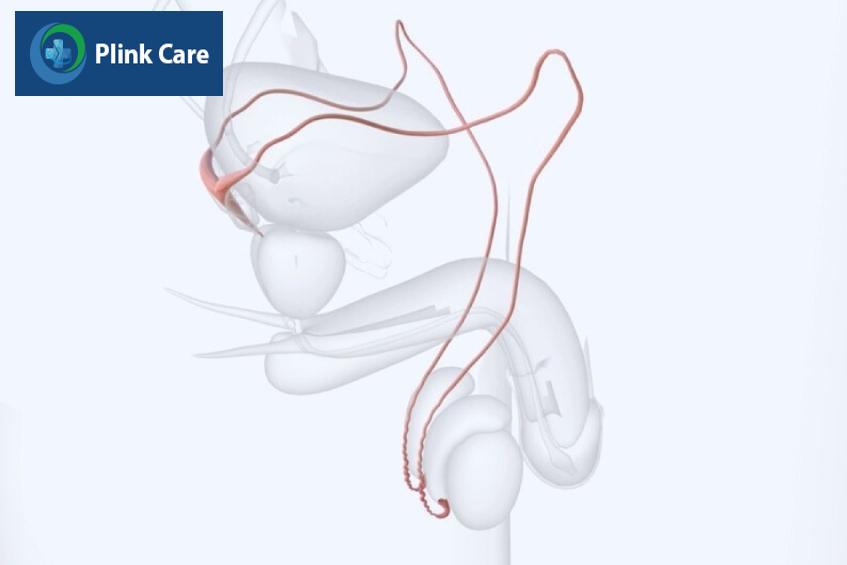ông dẫn tinh màu đỏ có kích thước rất nhỏ