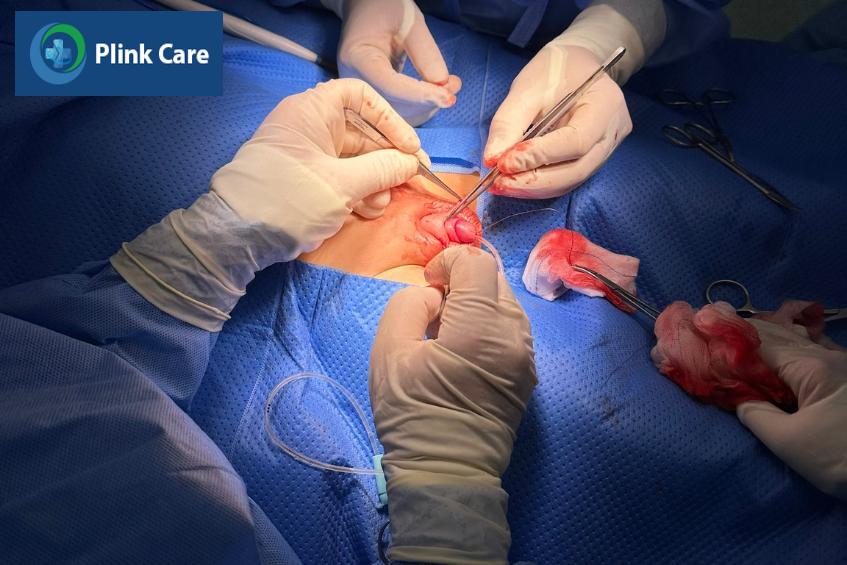 Phẫu thuật đưa dương vật về vị trí bình thường cho trẻ