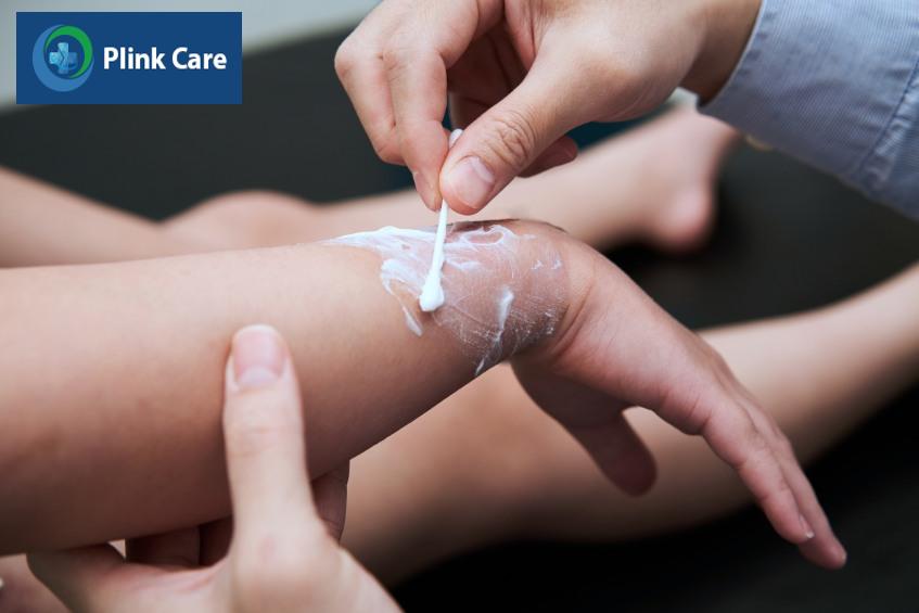 Thoa thuốc trị bỏng cho trẻ theo chỉ định của bác sĩ