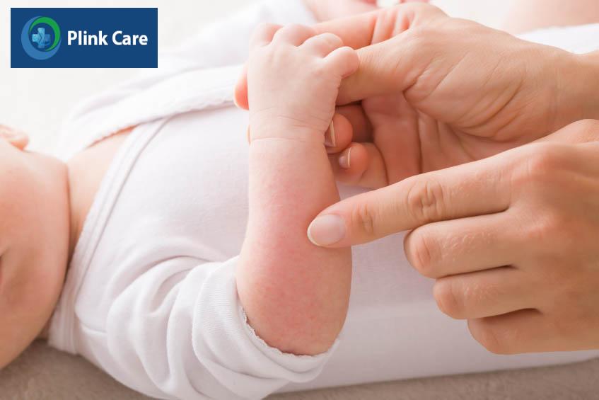 trẻ bị dị ứng khi dùng men vi sinh Enterogermina
