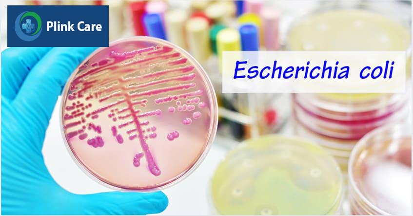 Vi khuẩn E.coli có khả năng phát triển kháng kháng sinh