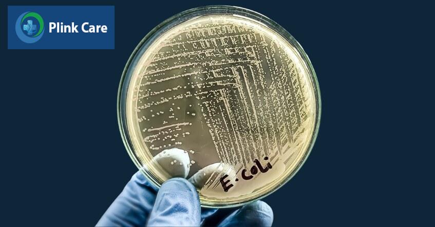 vi khuẩn e coli