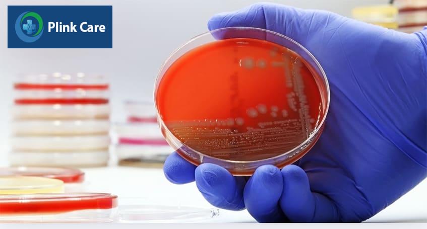 Viêm bàng quang nhẹ do E.coli gây ra có thể tự khỏi