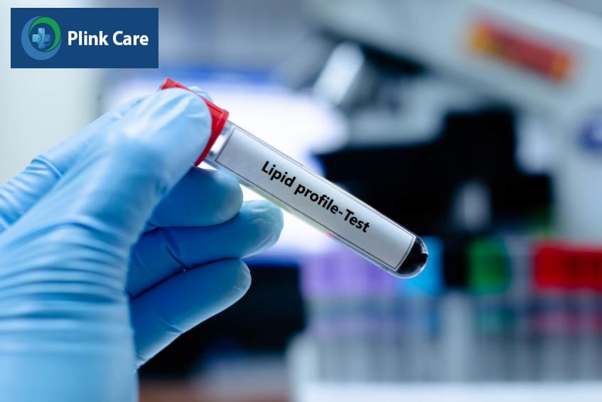 Xét nghiệm máu giúp chẩn đoán tình trạng rối loạn chuyển hóa lipid